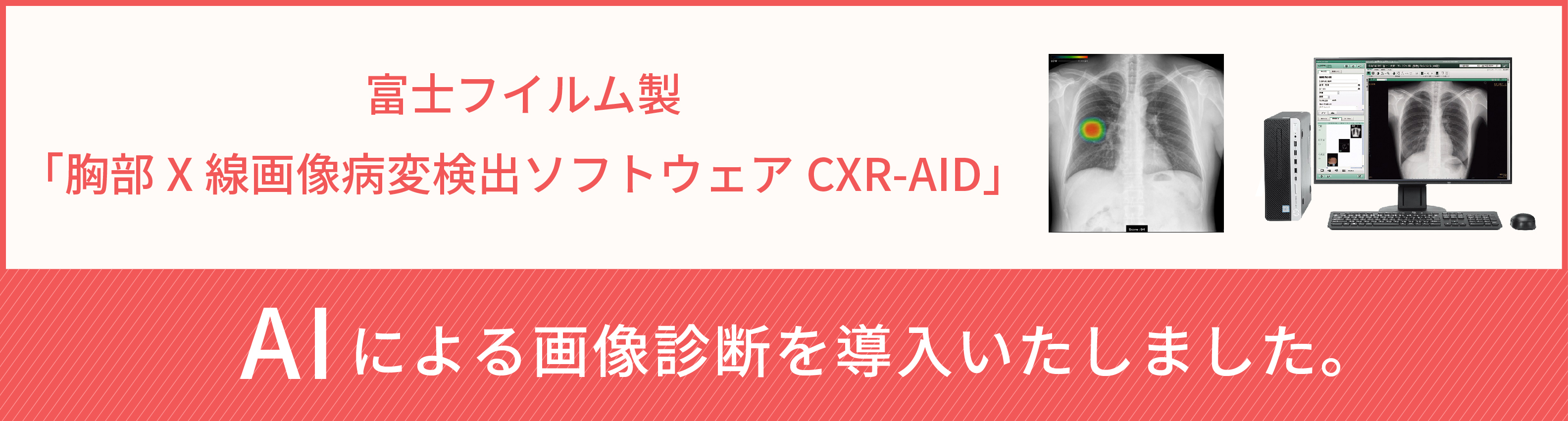富士フィルム製「胸部 X 線画像病変検出ソフトウェア CXR-AID
